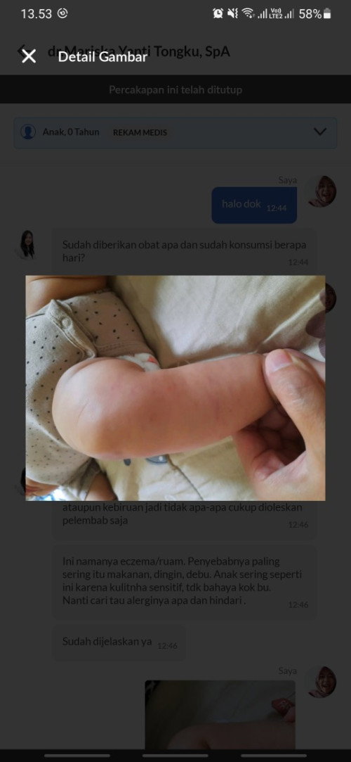 Bercak merah dan biru di kaki