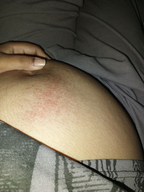 Jatuh saat hamil 22 minggu