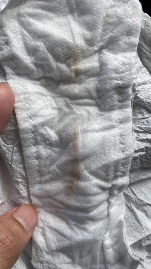 Normal ke spotting ni mommies? 😖