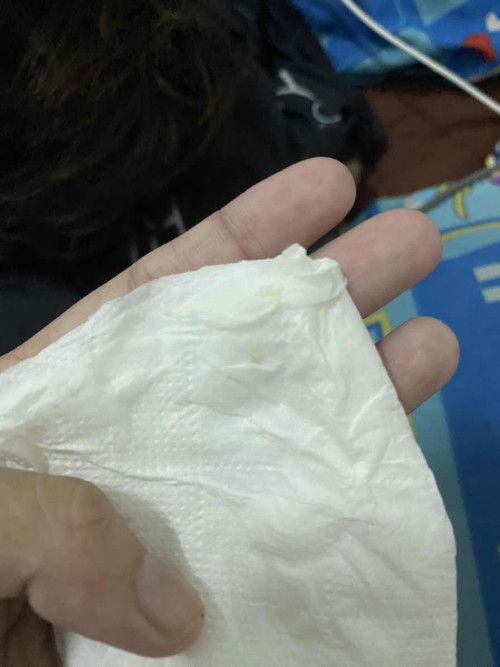 ตกขาวแบบนี้ผิดปกติไหมคะ