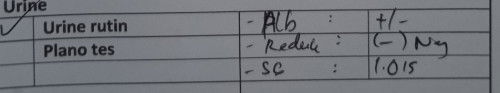 Hasil Lab tes urine