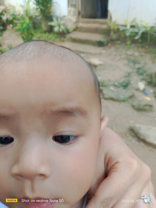 Nakaumbok yung bunbunan n baby 6 mos. old