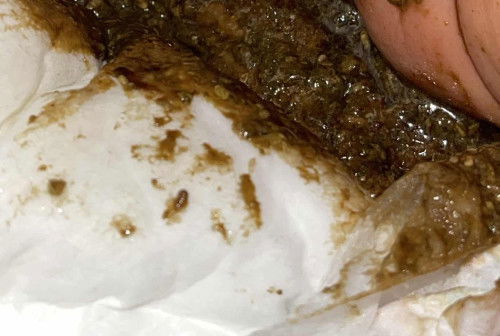 น้องถ่ายสีนี้ปกติไหมค่ะ