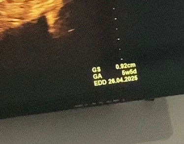 Hitungan Usia Kehamilan Berbeda di Aplikasi dan USG