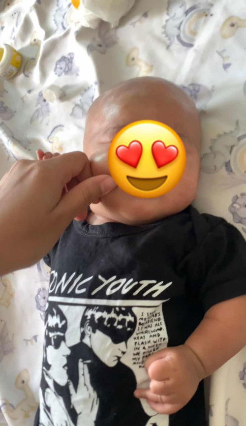 botakin baby😍🥹