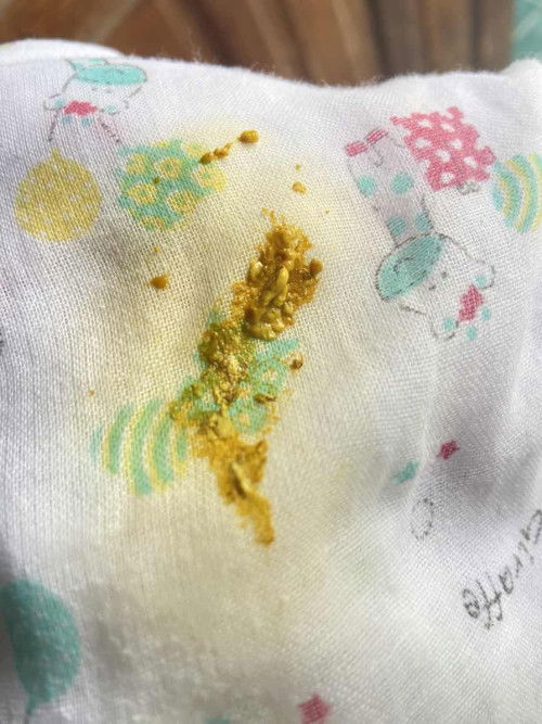 อายุ22วัน น้องถ่ายแบบนี้ปกติไหมคะ