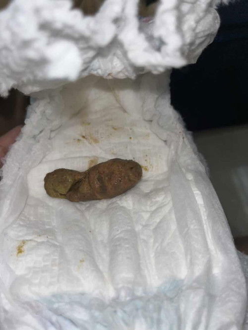 Apakah ini tanda sembelit?