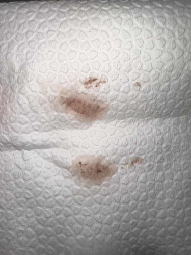 6 weeks and 4/6 days light red spotting