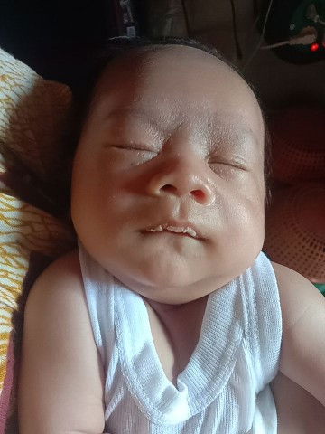 Bibir bayi putih