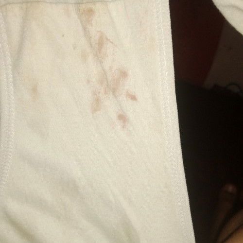 20 week 5 hari keluar flek apakah berbahaya