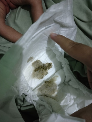 BAB bayi newborn 7 hari ini kenapa yaa bund? Saya jadi khawatir