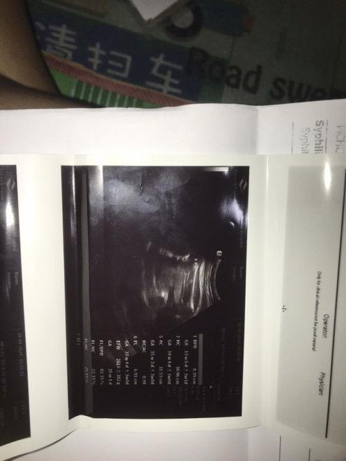 ช่วยดูหน่อยคะว่าน้องเป็นผญหรือผช