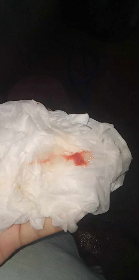 37วีค4วันก่อนหน้านี้ก็เคยออกหมอบอกปากมดลูกยังไม่เปิดไม่ท้องเเข็งออกตั้งเเต่มื้อวานค่ะ