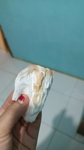 Saya hamil 23 minggu kok ad cairan keluar gt ya, trus disertai dgn nyeri pinggang dan perut