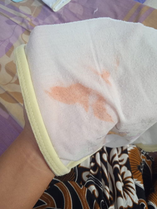 Keluar bercak merah di popok