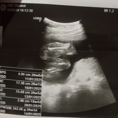 ช่วยดูเพศลูกให้ทีค่ะพอดีดูยังไงก็ดูไม่ออก😅