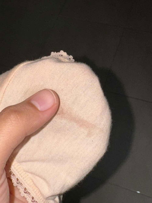 Keluar darah/ perang 34w