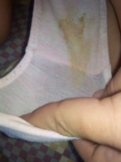 Hello po momies , anong pong ibig sabihin kpg ganito napo nalabas sa akin . 38weeks and 2days napo .