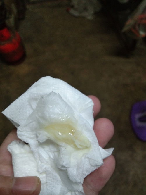 มีมูกขาวๆหนืดๆเหมือนกาวออกมา