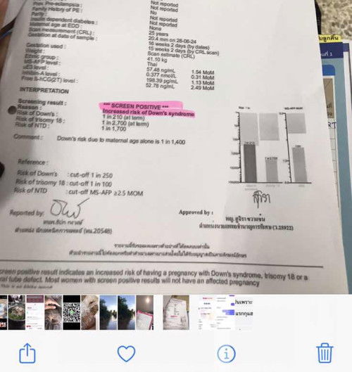 ผลเสี่ยงสูงค่ะ