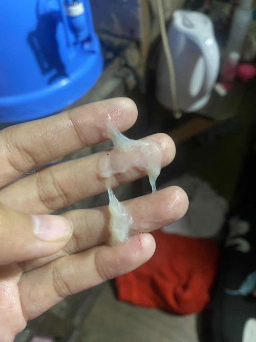 DischargeMi normal lang po ba ito? I am 24 weeks pregnant po please respect post po please