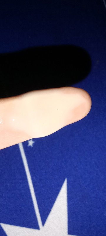 Keputihan dari awal positif hamil