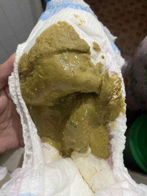 น้องอึสีนี้ปกติมั้ยคะ