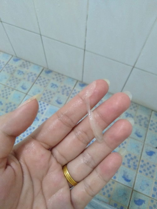 ท้อง38+6wแล้วค่ะ