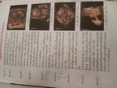 มาดูน้ำหนักช่วงอายุครรภ์กันค่ะ