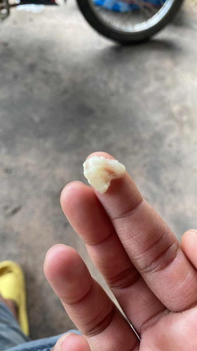 38วีคมีมูกขุ่นๆออก