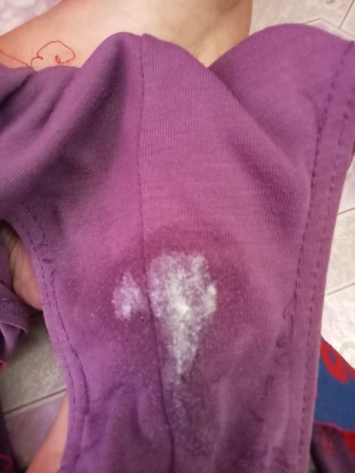 37 weeks white creamy discharge