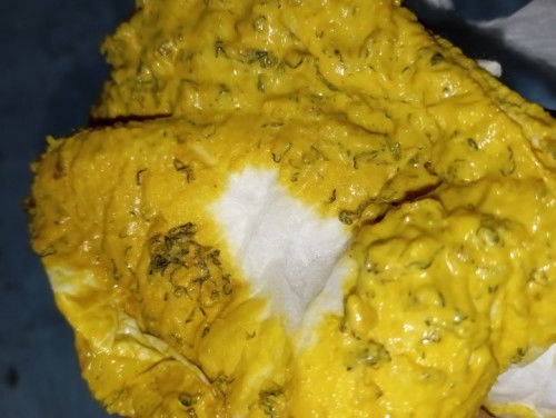 Kenapa pup bayi saya seperti ada rambut kecil kecil nya yah