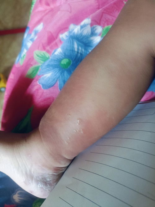 สอบถามแม่ๆคะ