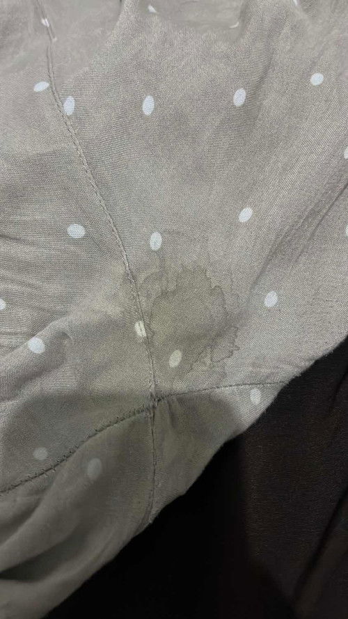 Rembesan Ketuban atau Keputihan