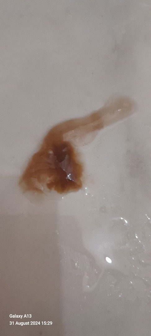 Lendir Coklat Pasca 3 Bulan SC