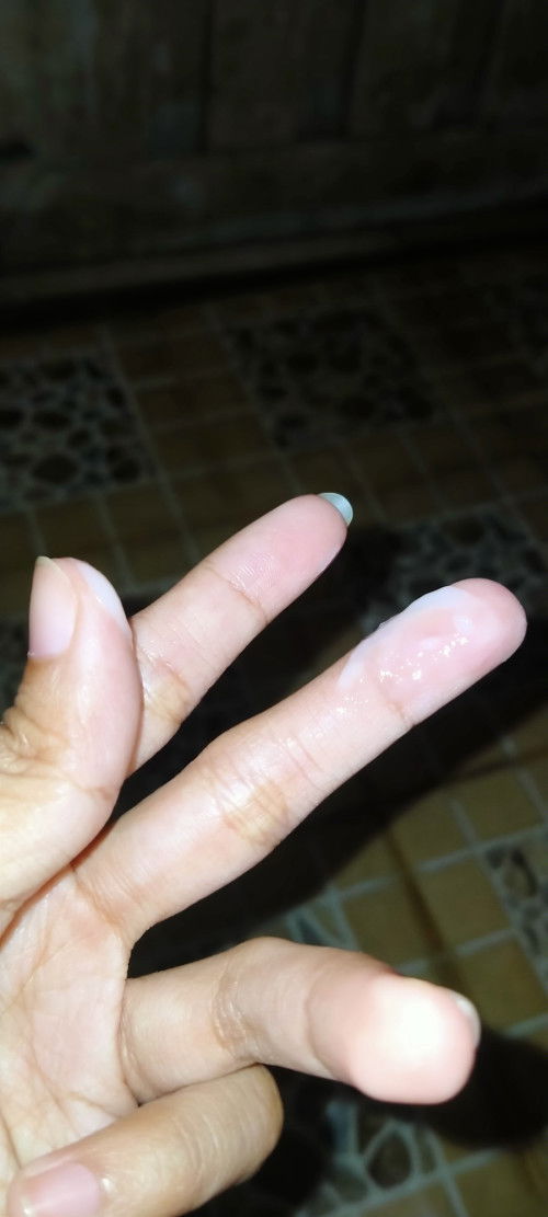 Keputihan seperti susu