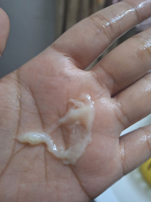 Second baby😢😍😍🥰