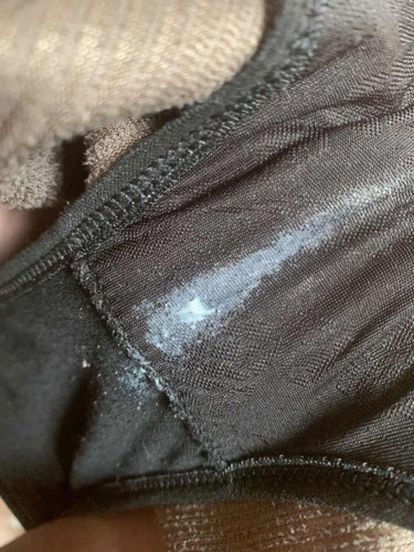 ตกขาวแบบนี้ปกติมั้ยคะ 35+5วีค