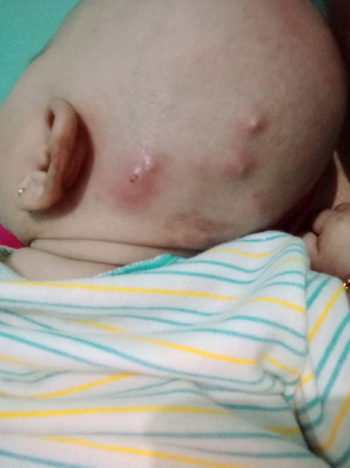 Ada yg anaknya pernah kayak gini ga bin? Anak saya baru umur 1 setengah bulan. Kira² ini kenapavyah?