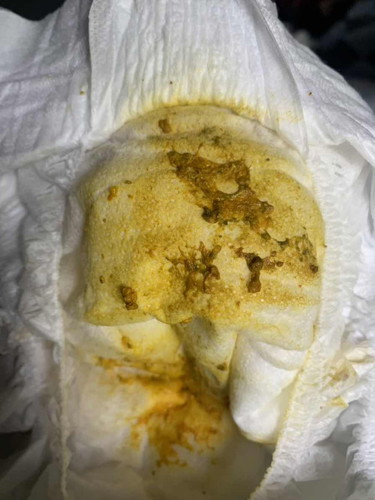 สีอุจจาระเด็กแรกเกิด