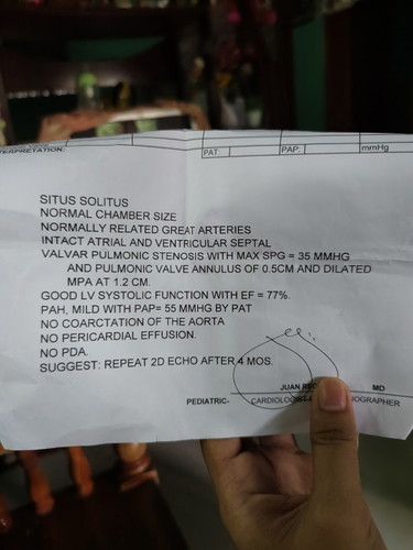 Help!! 2d echo result ni baby