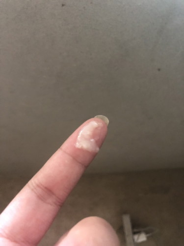 ใช่มูกใกล้คลอดมั้ยคะ