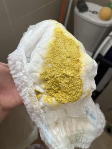 อึแบบนี้ปกติมั้ยค่ะ