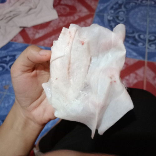 ลูกแหวะนมบ่อย อายุ3เดือน