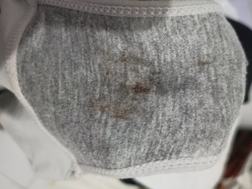 Bun mau nanya, hari kamis kmrn saya ke dokter obgyn dan usia kandungan sudah 5week