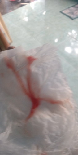 Tanong ko lang po 37wks na po ako now after IE 3dys na nakalipas ganyan po lumabas sakin