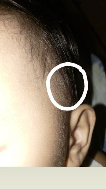 Hello po mga mii ask lang po ako normal lang po kaya sa bata yan?