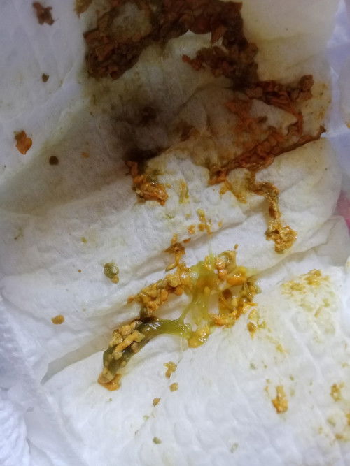 Parang  plemas  na dumi  ni baby