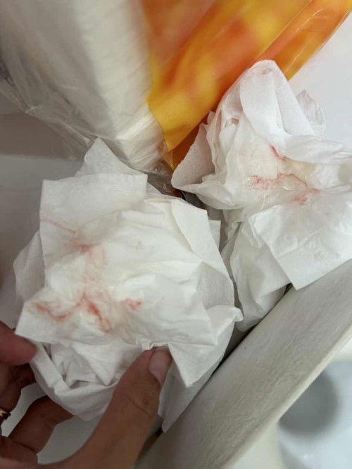 Keluar lendir bercampur darah saat hamil 25 week