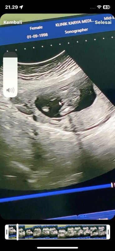 INI KELAMIN ATAU TALI PUSAR BUNDA2 CANTIK???